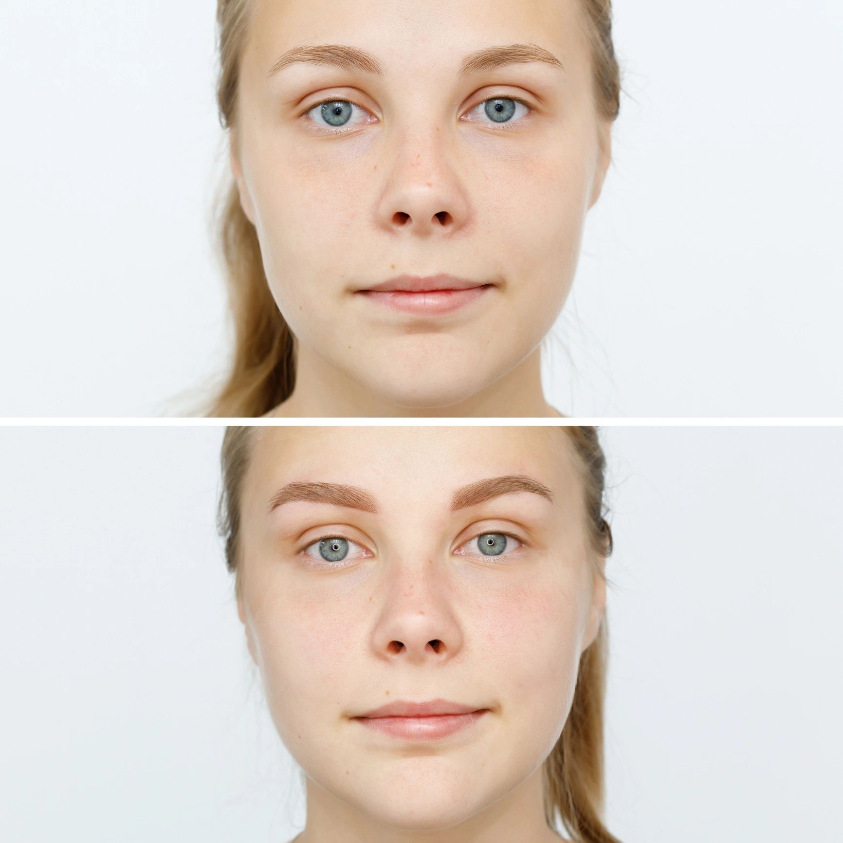 Before and after eyebrow treatment comparison