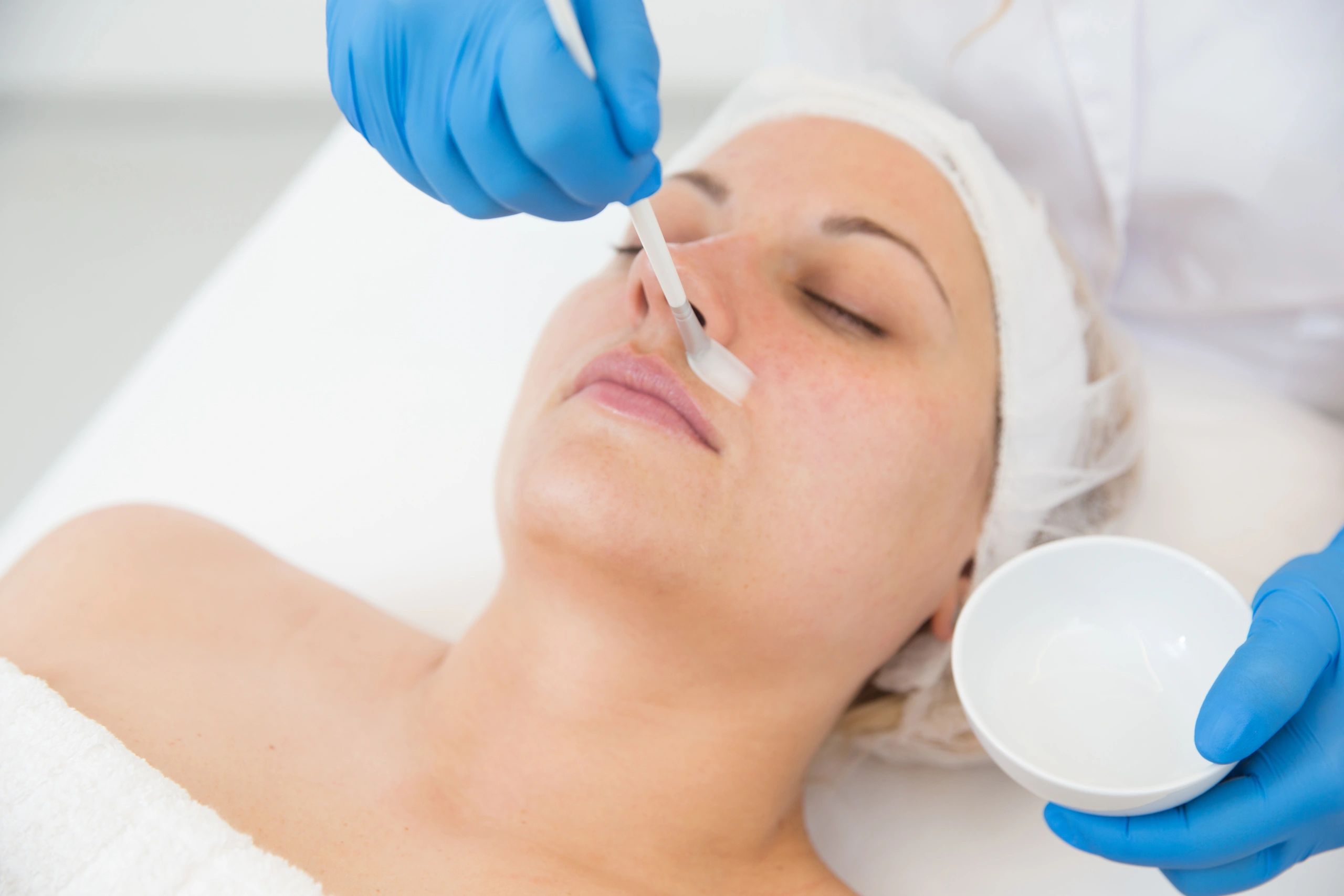 Chemical peel being applied during a professional facial treatment