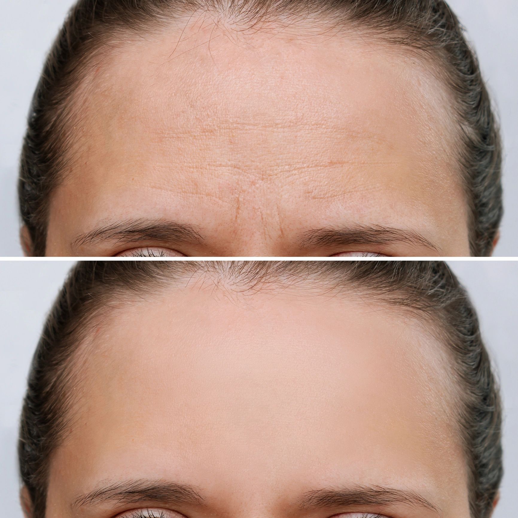 Before and after anti-aging treatment comparison