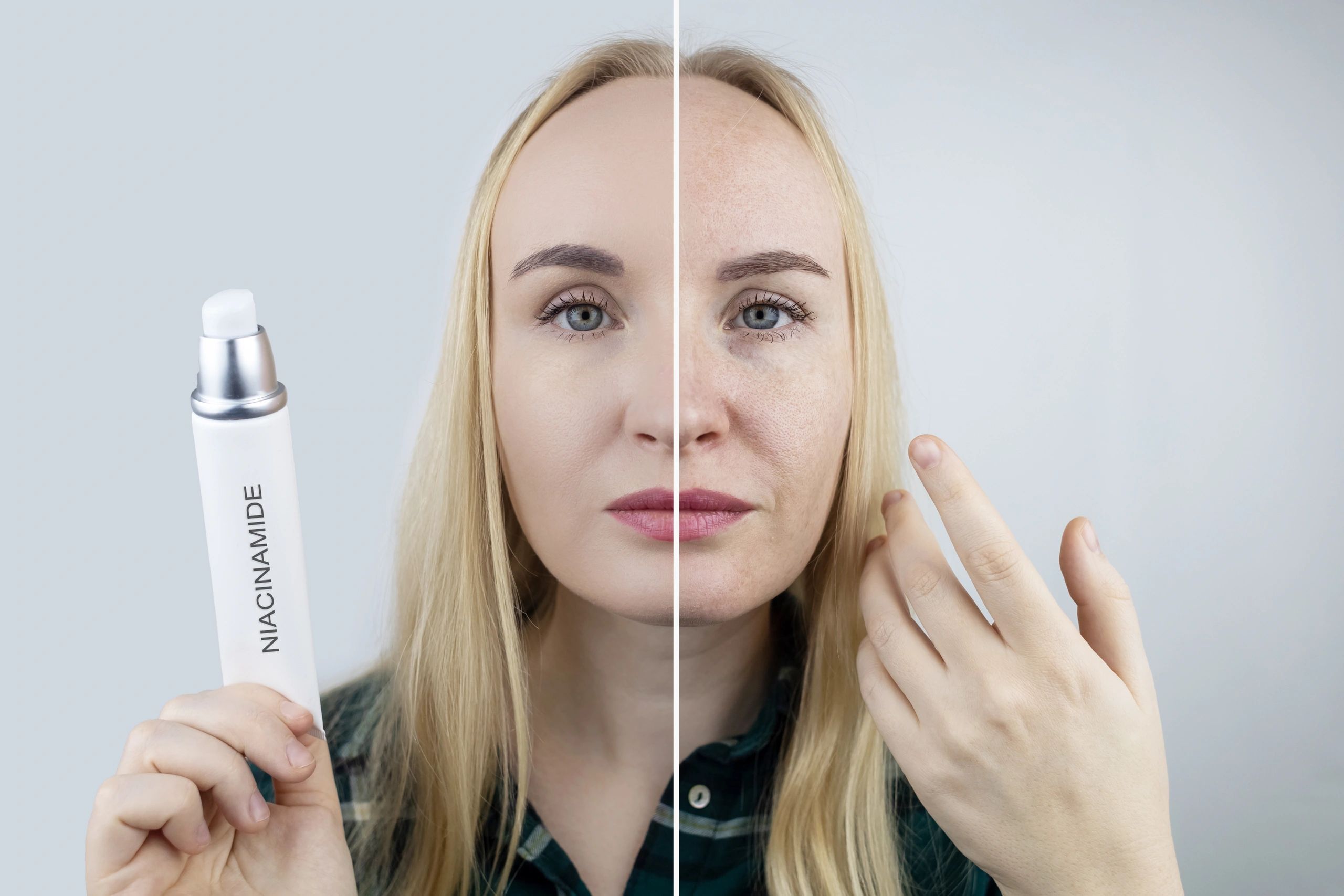 Before and after skincare result with cream