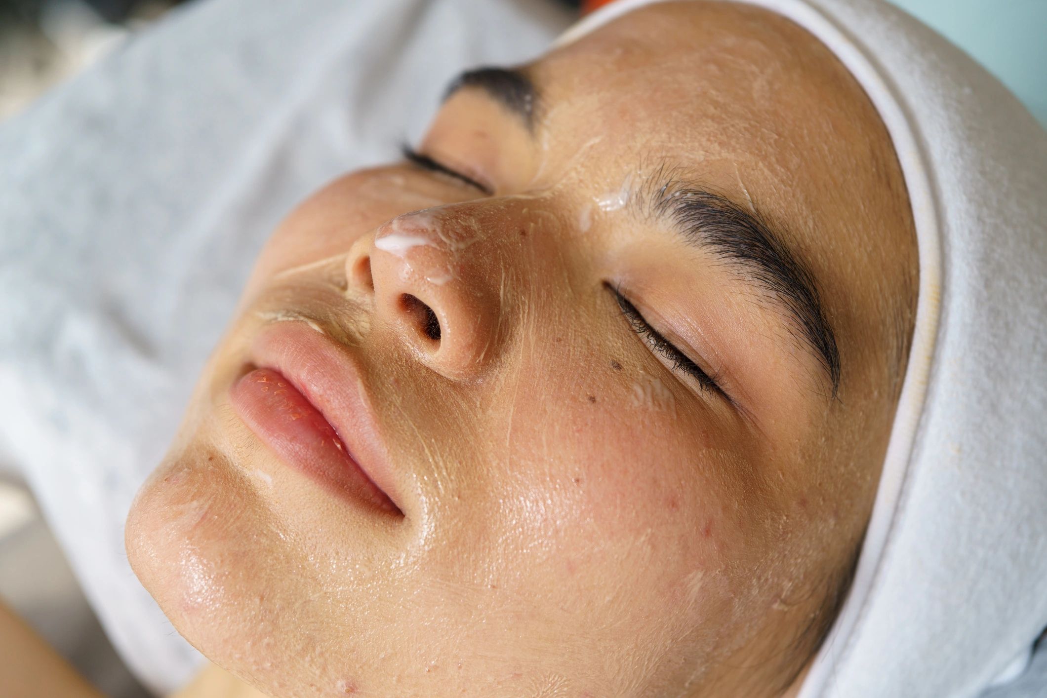 Client receiving a professional facial cleansing treatment in a clinic